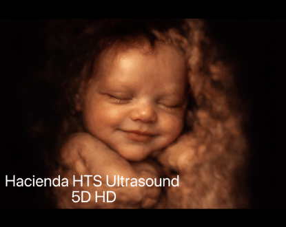 3D, 4D, & HD (5D) ULTRASOUND